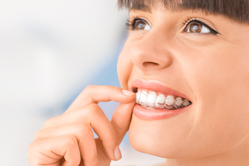 Invisalign in Oxon Hill