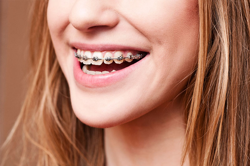 Orthodontics in Oxon Hill